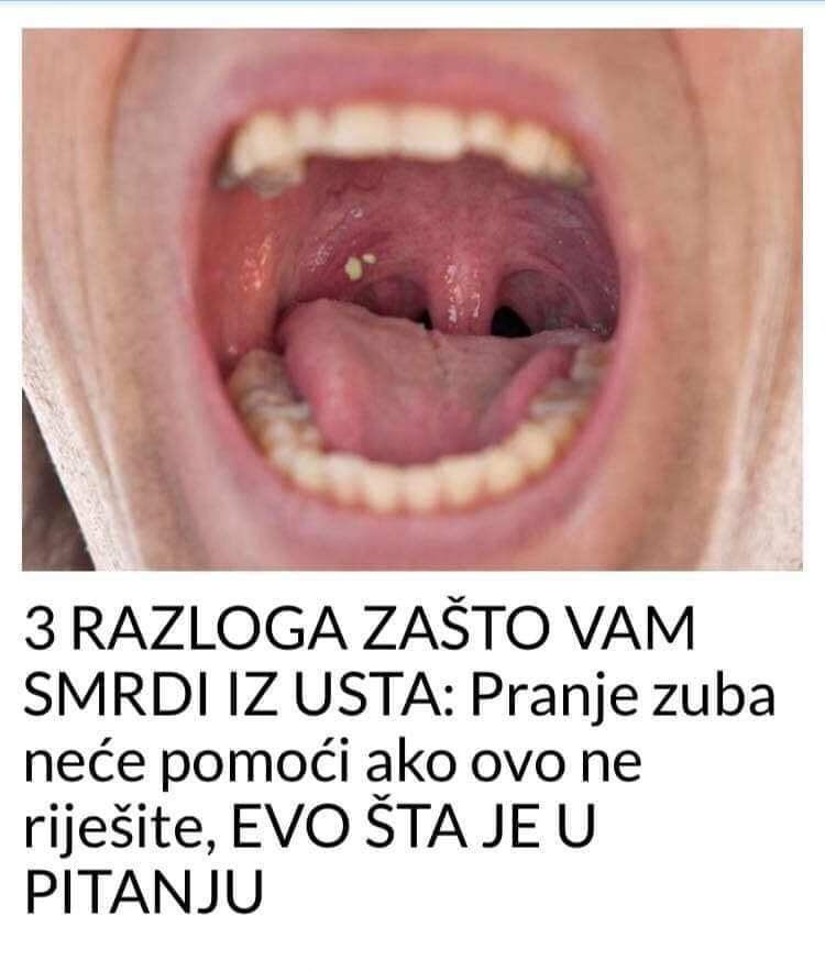 Da bi se problem lošeg zadaha trajno otklonio