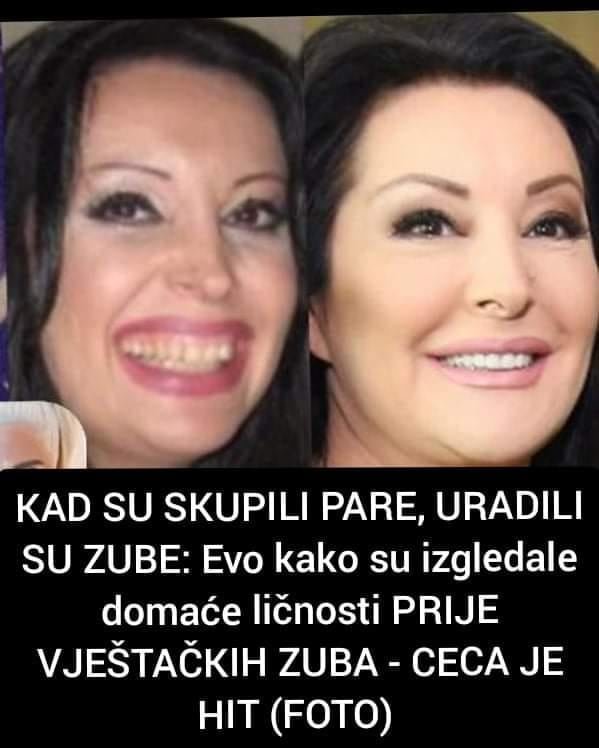 Naizgled mala intervencije vilice može napraviti veliku razliku