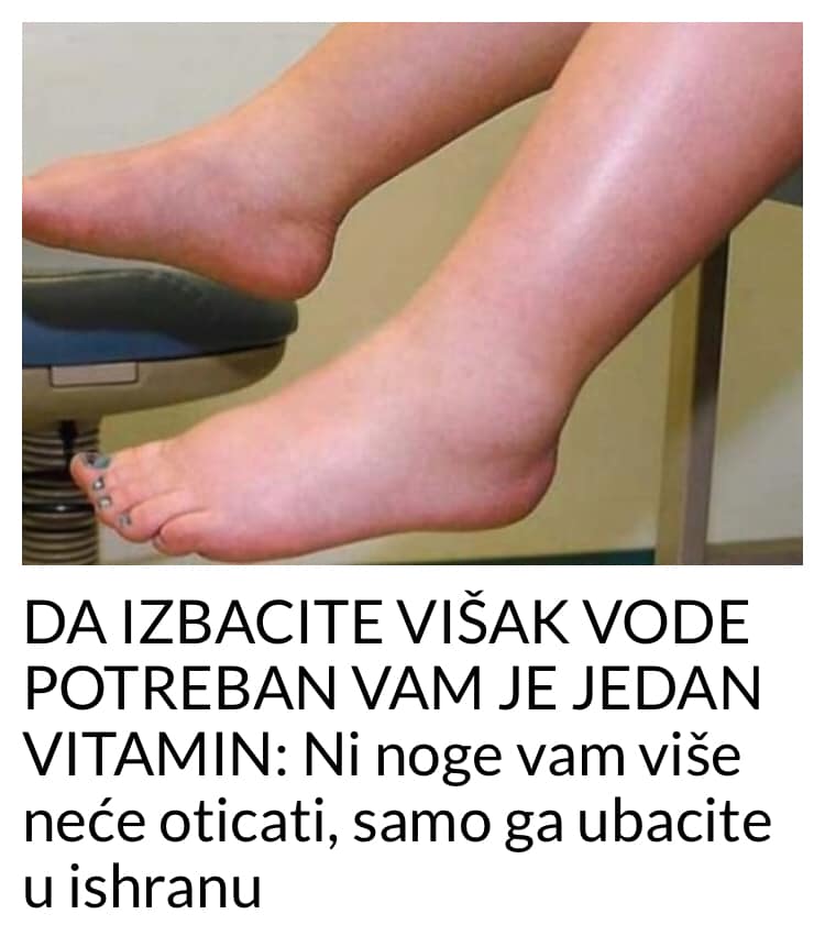 DA IZBACITE VIŠAK VODE POTREBAN VAM JE JEDAN VITAMIN:  Ni noge vam više neće oticati, samo ga ubacite u ishranu