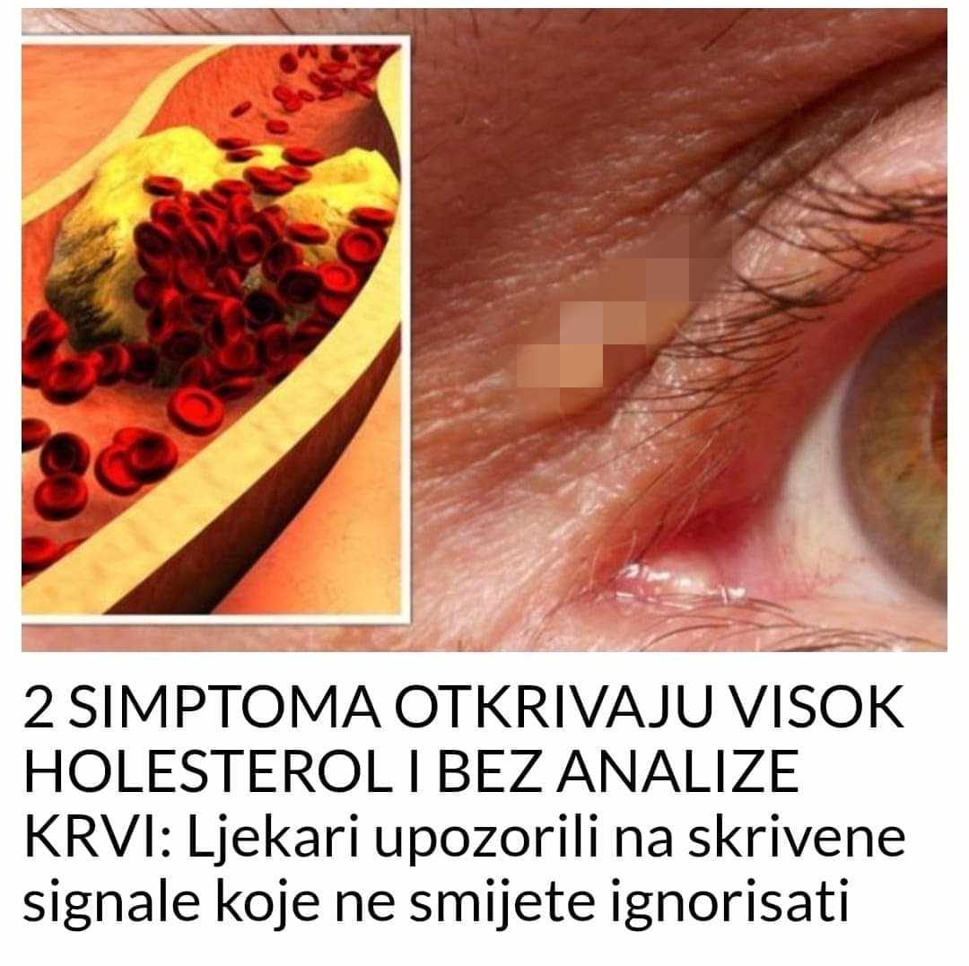 Zbog brzog i nezdravog načina života, povećava se broj oboljelih od