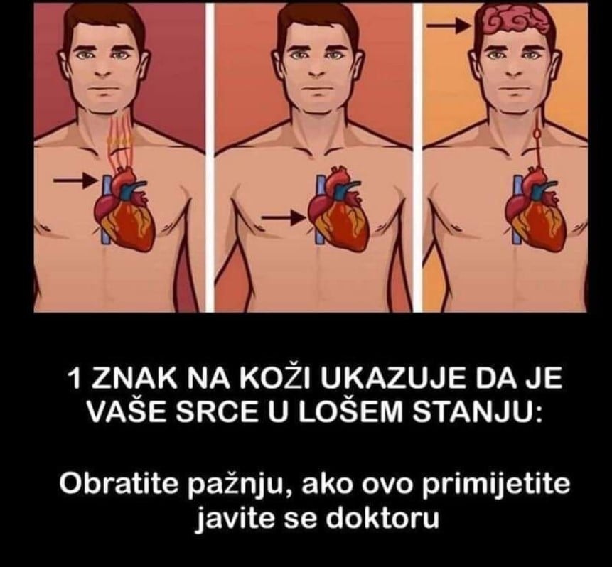 Održavati vaše srce zdravim je važno, ali važno je