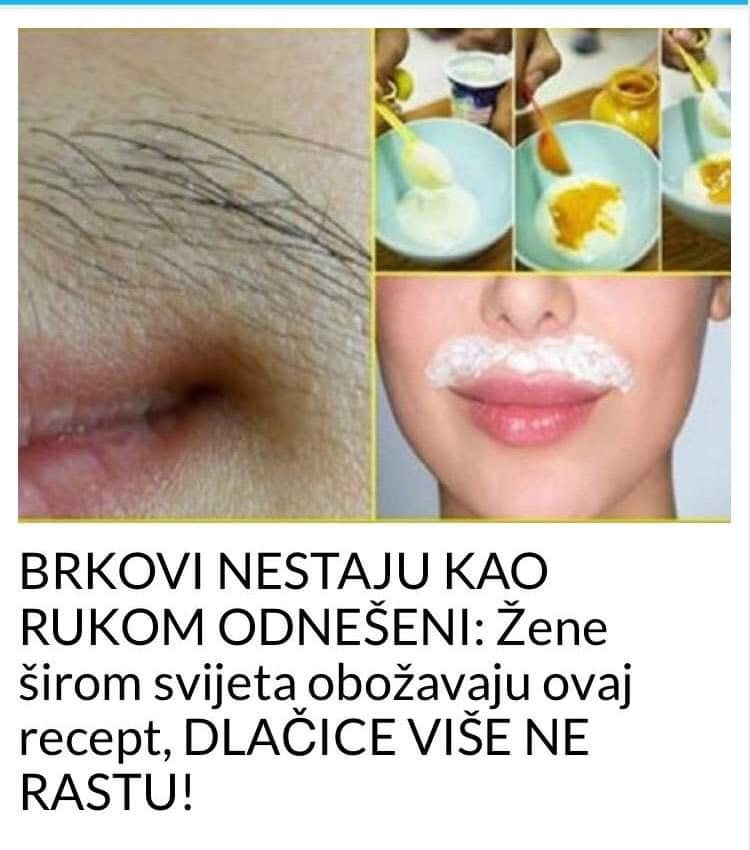 BRKOVI NESTAJU KAO RUKOM ODNEŠENI:  Žene širom svijeta obožavaju ovaj recept, DLAČICE VIŠE NE RASTU!