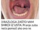 Da bi se problem lošeg zadaha trajno otklonio