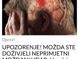 N eprimjetni moždani udar, također poznat kao subklinički