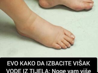 Da li ste primjetili duboke tragove od ne tako uskih čarapa na vašim