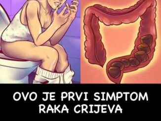 Da li ste znali da je rak debelog crijeva je treći najčešći rak