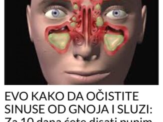 Sinusitis može biti izazovne česte i uporne glavobolje