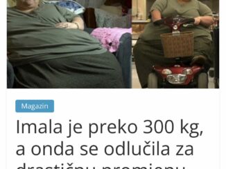 Priča ove nekad morbidno pretile žene je nevjerojatna