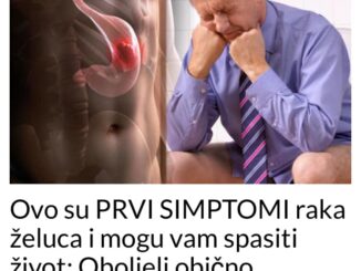 Želudac je veoma važan organ u našem organizmu 