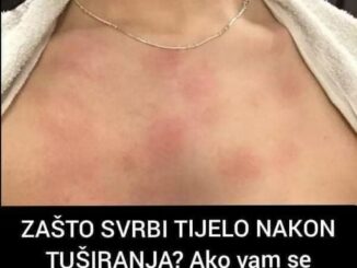 Svrabež kože nakon tuširanja može biti poprilično