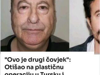 Operacija podmlađivanja lica u posljednje vrijeme dobija na popularnosti