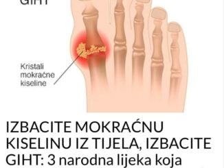 Nakupljanje mokraćne kiseline može prouzrokovati