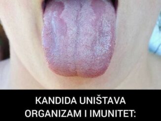 Candida Albicans je najčešći tip